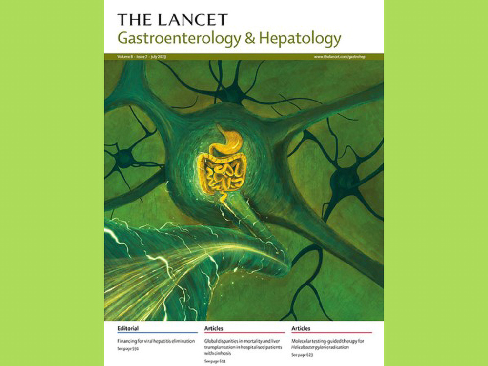 臺大醫院院長吳明賢領軍之研究成果刊登於國際頂尖期刊《刺胳針胃腸肝病學》-封面圖